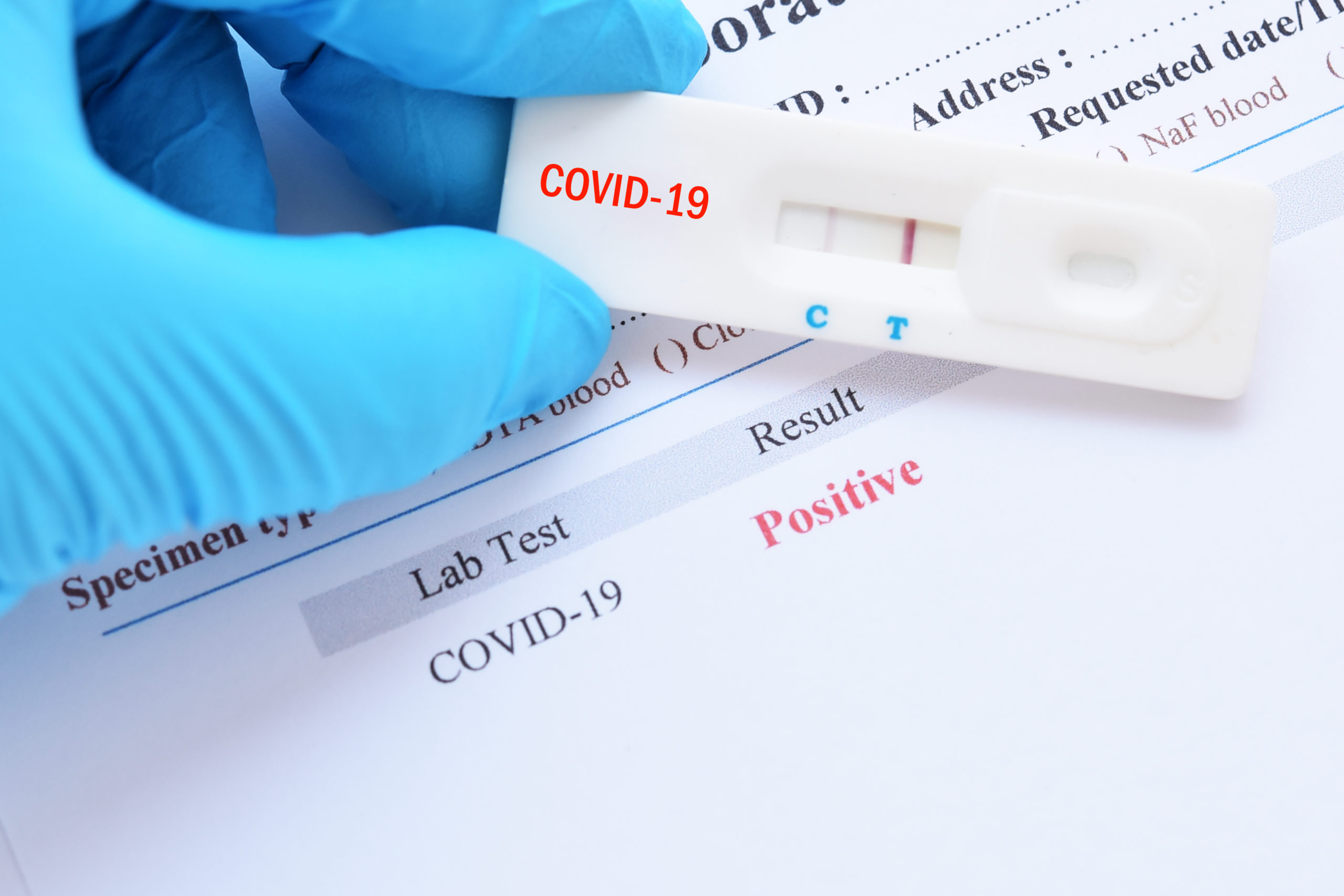 Test Coronavirus Antígenos
