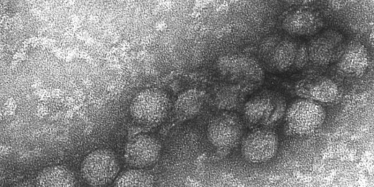 Virus del Nilo Microscopio