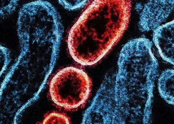 Virus Nipah: ¿Qué es?